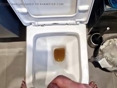 Just a little regular urine in the toilet and